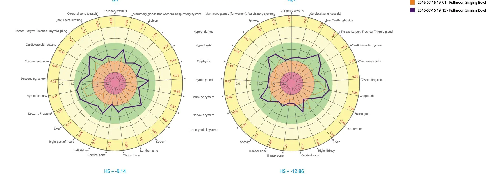 Compare diagram 2016-07-24 15_15 S