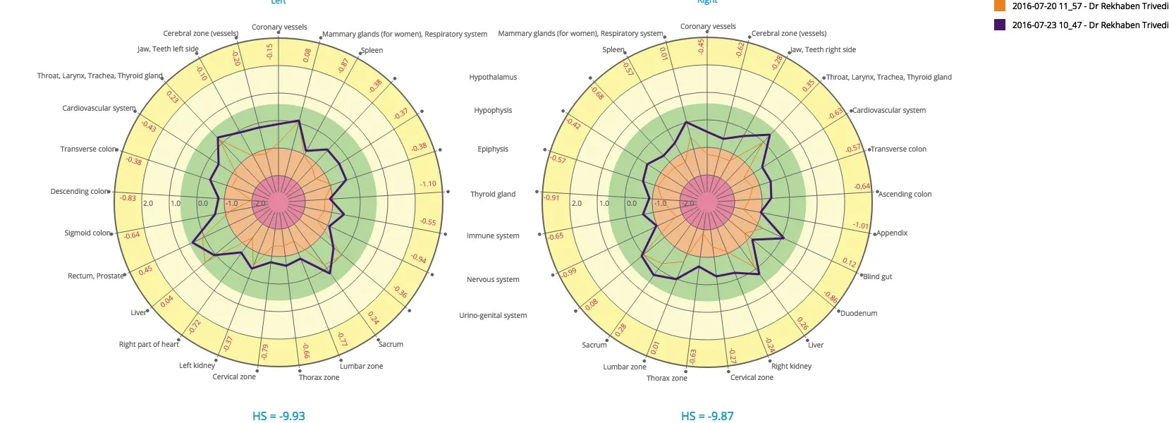 Compare diagram 2016-07-24 15_30 S